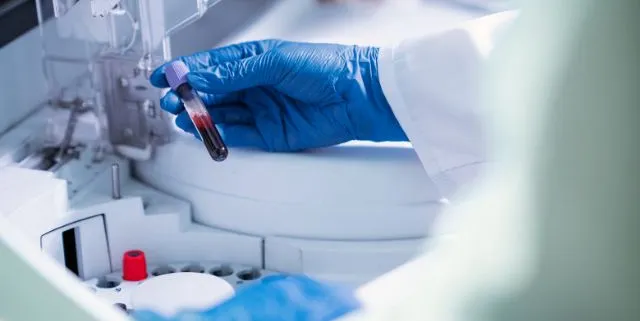 Imagen cabecera post